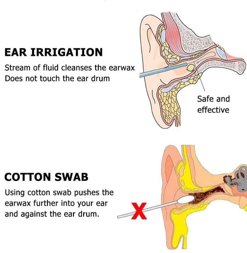 Ear Washer and Ear Irrigation Kit: image 6
